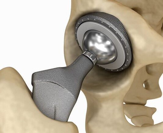 Кваліфікована допомога ортопеда при болях різної етіології