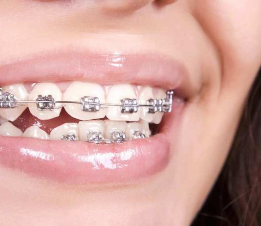 Инновации для здоровья и экологии на примере одесской стоматологии